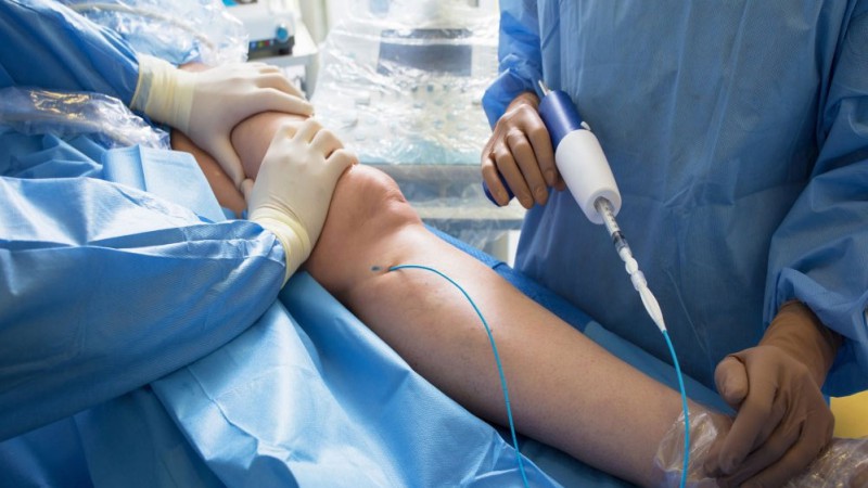 کلینیک واریس و بیماری های وریدی