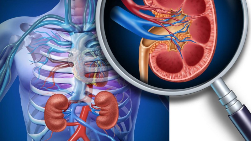 درمان عوارض عروقی بیماران دیالیزی