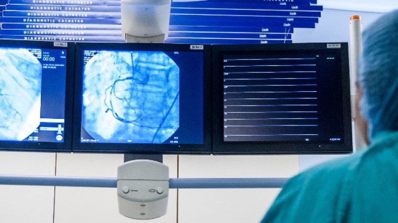 آنژیوگرافی تشخیصی