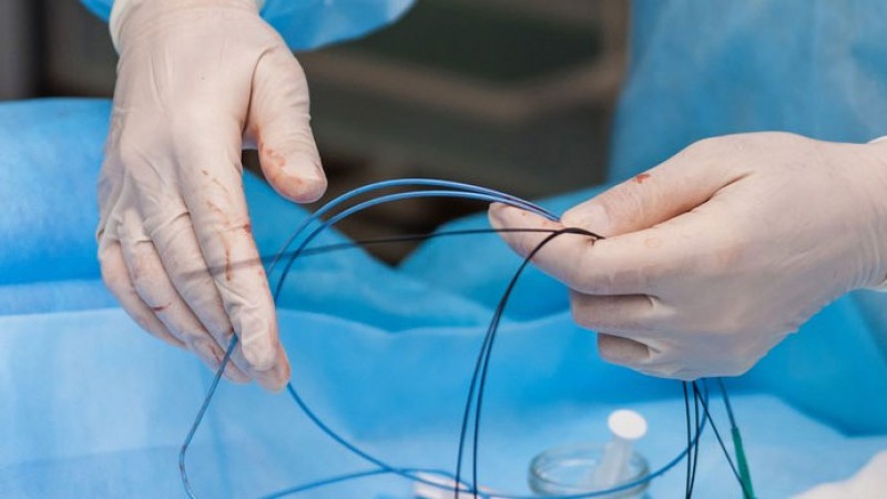 آنژیوپلاستی عروق قلب/استنت و بالن